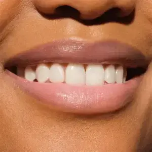 مراقبت از لب
